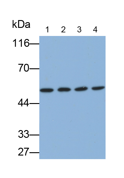 Anti-Tubulin Beta (TUBb) Monoclonal Antibody