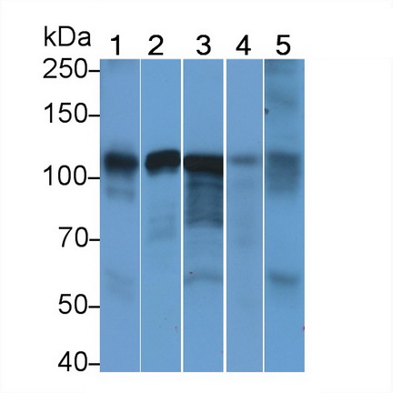 Anti-ATPase, Na+/K+ Transporting Alpha 1 Polypeptide (ATP1a1) Monoclonal Antibody