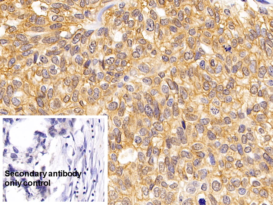 Anti-ATPase, Na+/K+ Transporting Alpha 1 Polypeptide (ATP1a1) Monoclonal Antibody