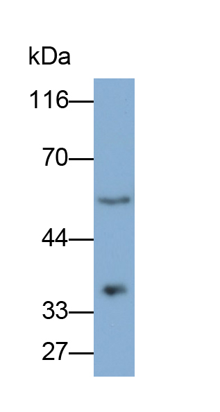 Anti-Voltage Dependent Anion Channel Protein 1 (VDAC1) Monoclonal Antibody