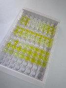 ELISA Kit for Free Triiodothyronine (fT3)