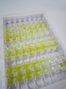 ELISA Kit for Vasoactive Intestinal Peptide (VIP)