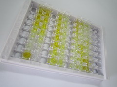 ELISA Kit for Vasoactive Intestinal Peptide (VIP)