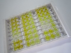 ELISA Kit for N-Terminal Pro-Brain Natriuretic Peptide (NT-ProBNP)