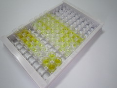 ELISA Kit for Brain Natriuretic Peptide (BNP)