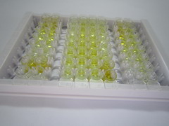 ELISA Kit for Aquaporin 5 (AQP5)