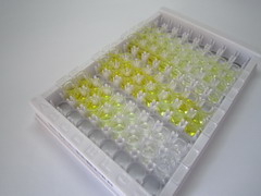 ELISA Kit for Trypsinogen Activation Peptide (TAP)