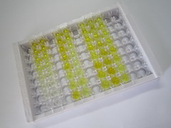 ELISA Kit for Trypsinogen Activation Peptide (TAP)