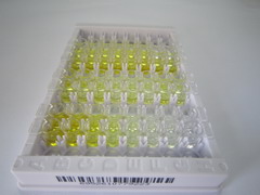 ELISA Kit for Cross Linked N-Telopeptide Of Type I Collagen (NTXI)