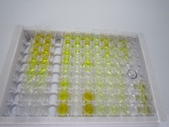 ELISA Kit for Ischemia Modified Albumin (IMA)