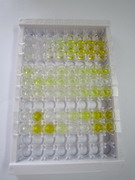 ELISA Kit for Adrenocorticotropic Hormone (ACTH)