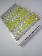 ELISA Kit for Adrenocorticotropic Hormone (ACTH)