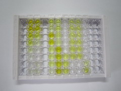 ELISA Kit for Beta-Crosslaps (bCTx)