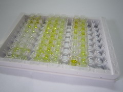 ELISA Kit for Procollagen I N-Terminal Propeptide (PINP)