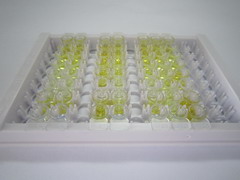 ELISA Kit for Kallikrein 1 (KLK1)