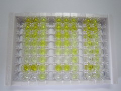 ELISA Kit for Pro-Gastrin Releasing Peptide (ProGRP)