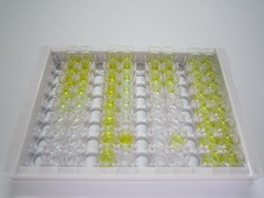 ELISA Kit for Gastrin (GT)