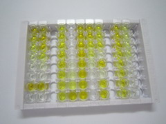 ELISA Kit for Luteinizing Hormone Beta Polypeptide (LHb)