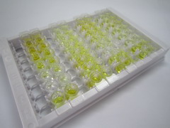 ELISA Kit for Gastric Intrinsic Factor (GIF)