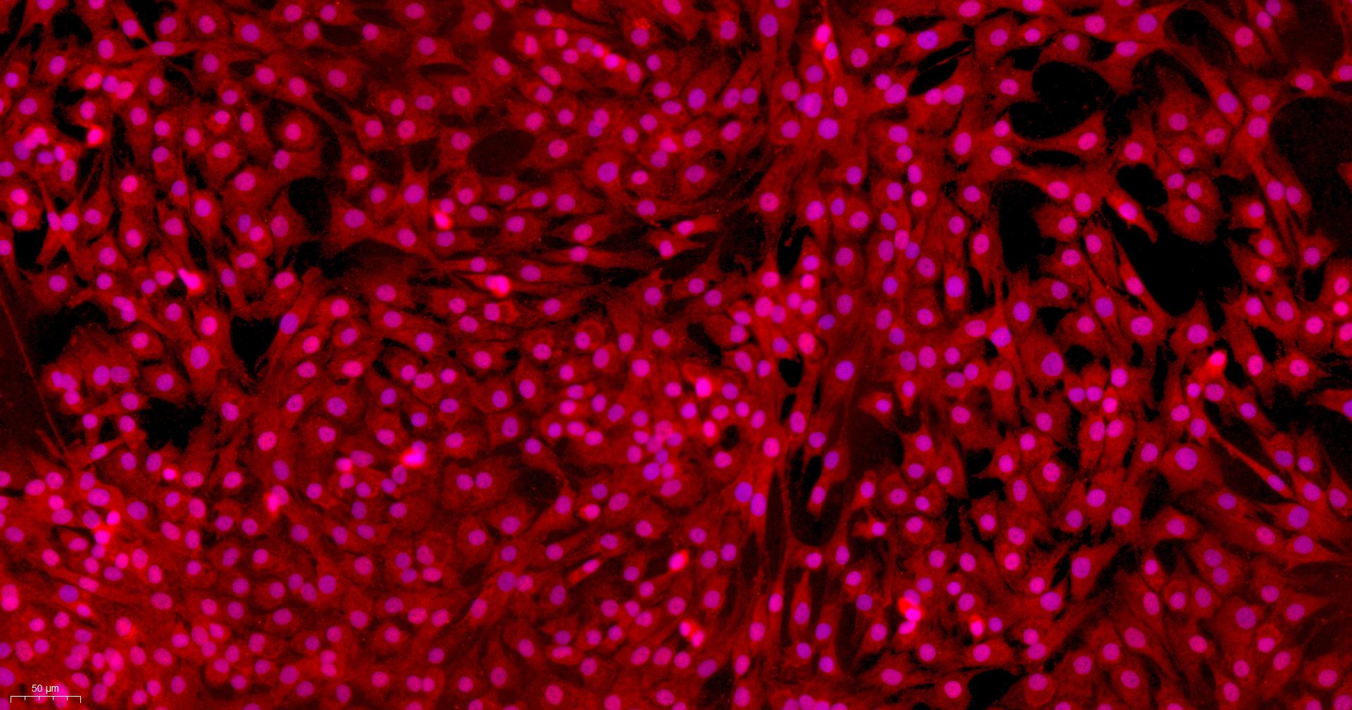 Primary Mouse Articular Chondrocytes (AC)