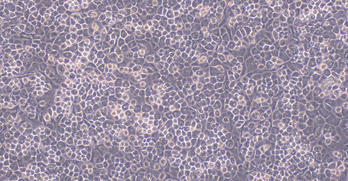 Primary Mouse Articular Chondrocytes (AC)