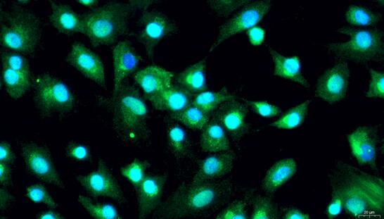 Primary Porcine Articular Chondrocytes (AC)