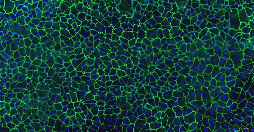 Primary Rat Cardiac Microvascular Endothelial Cells (CMEC)