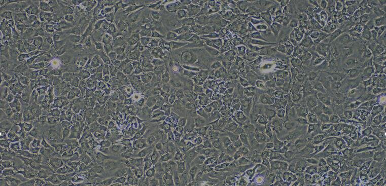 Primary Rabbit Cardiac Microvascular Endothelial Cells (CMEC)