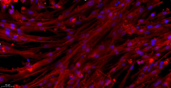 Primary Canine Aortic Endothelial Cells (AEC)