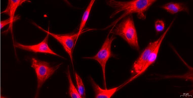 Primary Caprine Aortic Endothelial Cells (AEC)