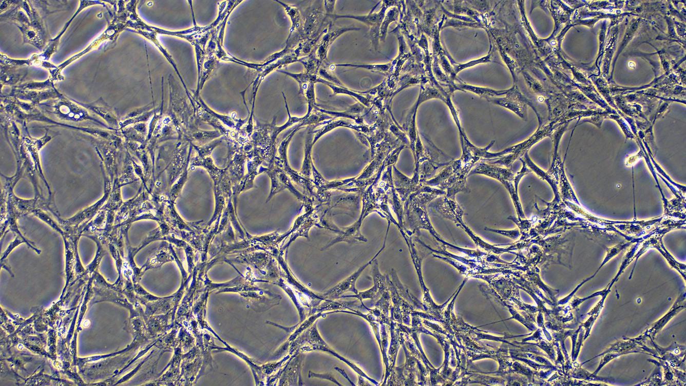 Primary Rat Aortic Endothelial Cells (AEC)