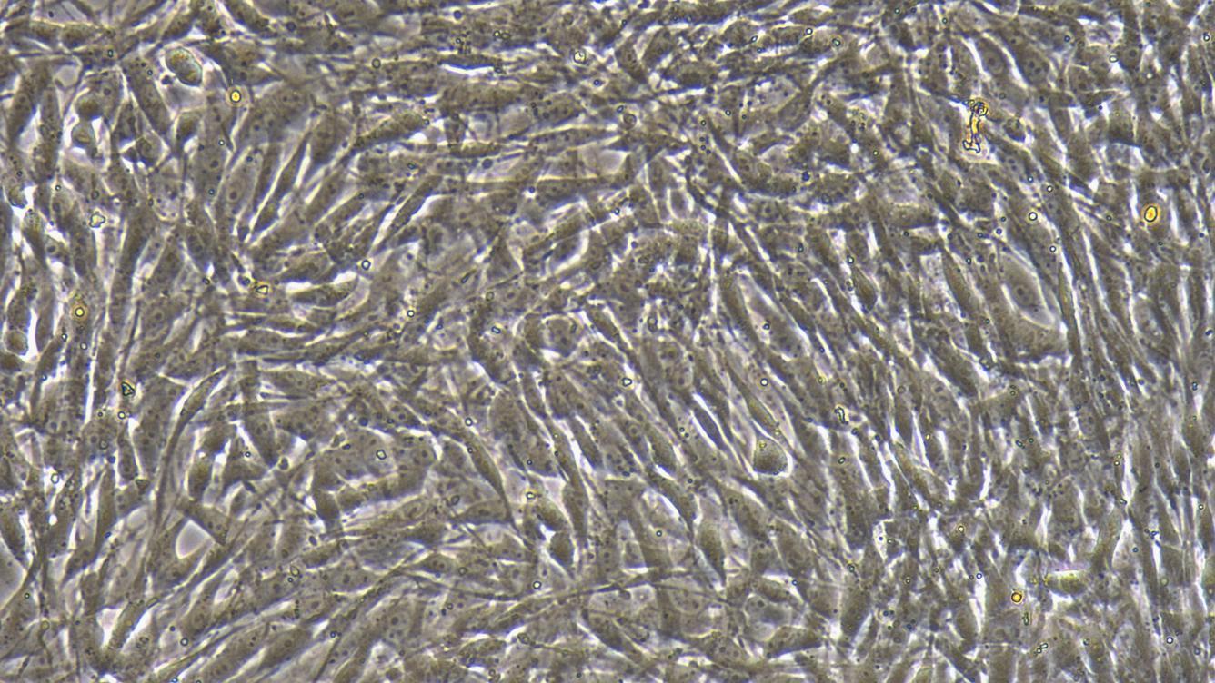 Primary Rat Aortic Endothelial Cells (AEC)