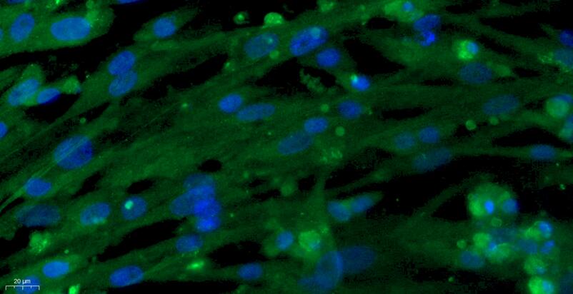 Primary Rabbit Aortic Endothelial Cells (AEC)