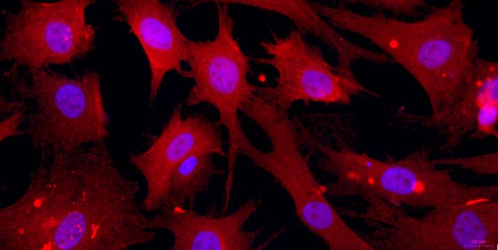 Primary Caprine Myocardial Cells (MC)