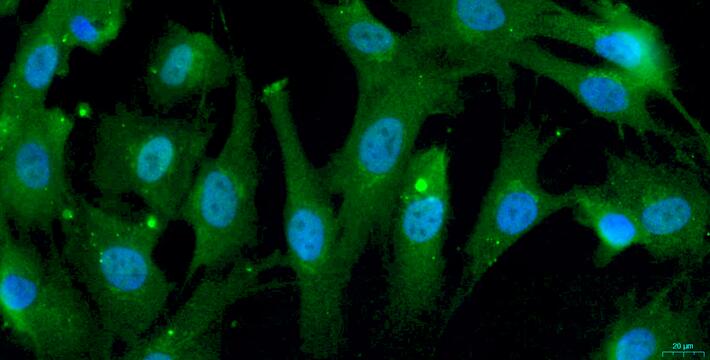 Primary Caprine Myocardial Cells (MC)