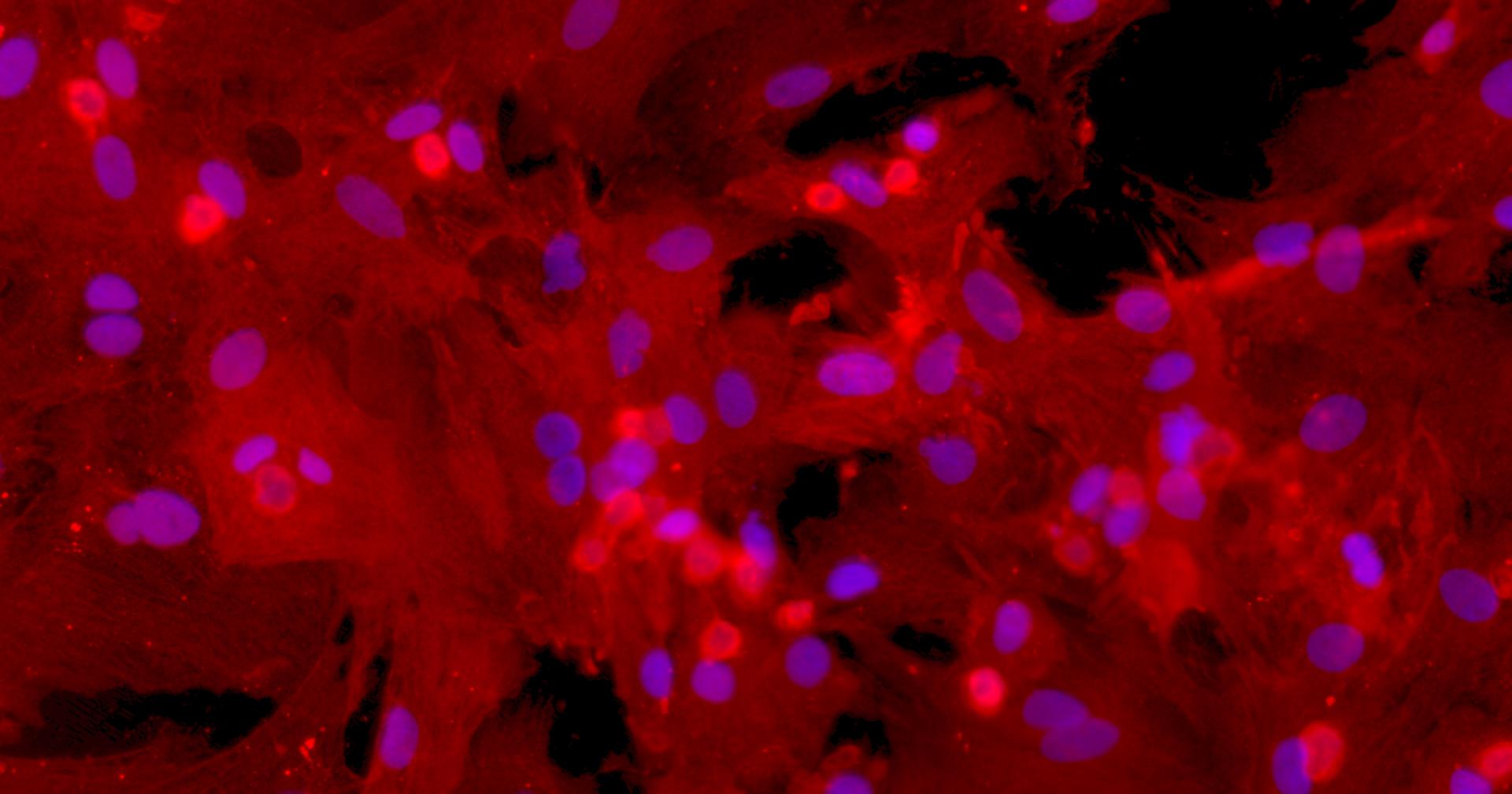 Primary Rat Myocardial Cells (MC)