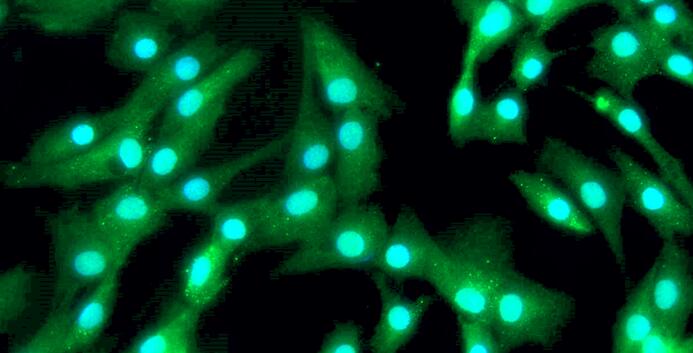 Primary Canine Annulus Fibrosus Cells (AFC)