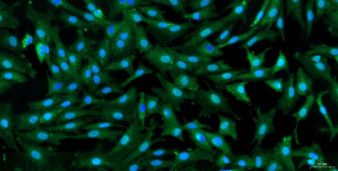 Primary Caprine Annulus Fibrosus Cells (AFC)