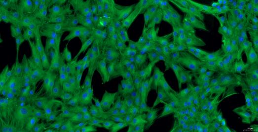 Primary Porcine Annulus Fibrosus Cells (AFC)