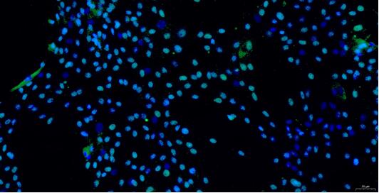 Primary Porcine Annulus Fibrosus Cells (AFC)