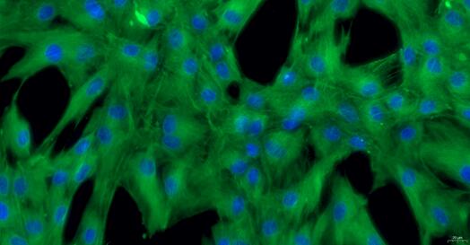 Primary Porcine Annulus Fibrosus Cells (AFC)