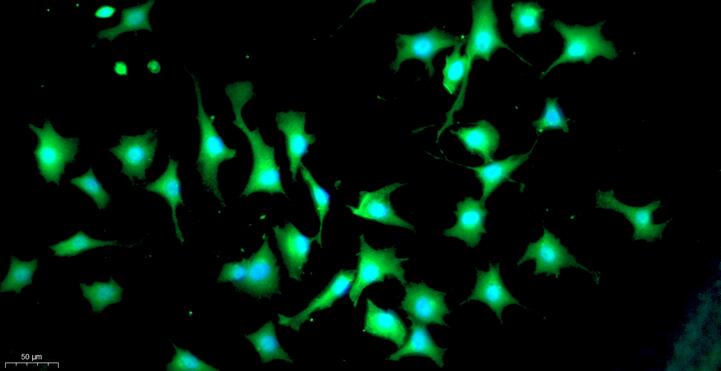 Primary Rat Annulus Fibrosus Cells (AFC)