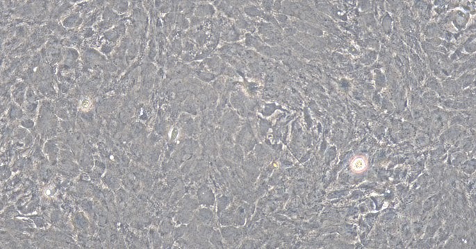 Primary Mouse Brain Astrocytes (BA)