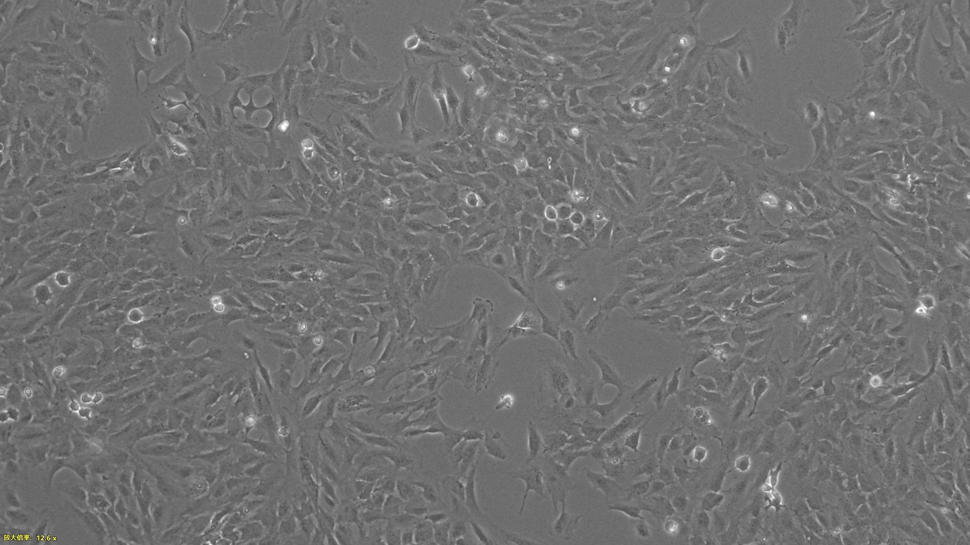 Primary Human Brain Microvascular Endothelial Cells (BMEC)