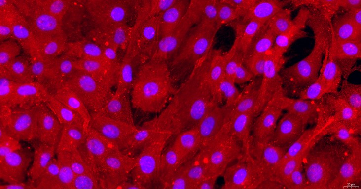 Primary Mouse Choroid Plexus Epithelial Cells (CPEC)