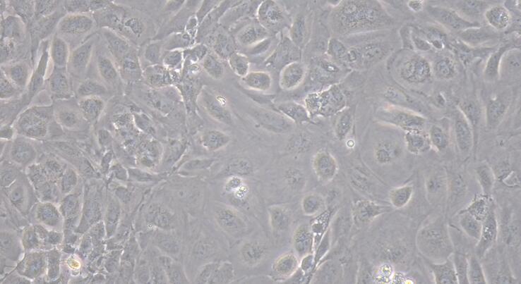 Primary Rabbit Umbilical Vein Endothelial Cells (UVEC)