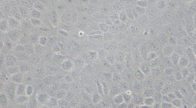 Primary Rabbit Corneal Epithelial Cells (CEC)