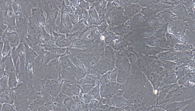 Primary Caprine Subcutaneous Preadipocytes (SPrAD)