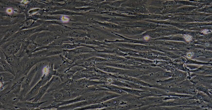 Primary Rat Pulmonary Fibroblasts (PF)