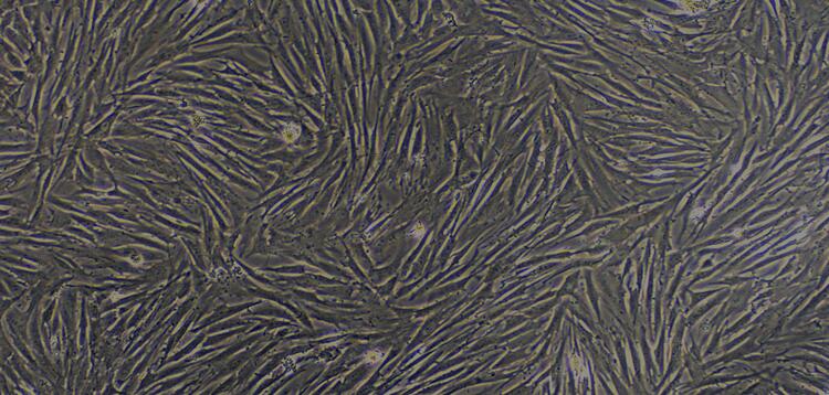 Primary Rabbit Pulmonary Fibroblasts (PF)